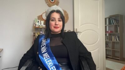 Gizem CENGİL-Emirhan YÜZÜGÜLDÜ/ANKARA, (DHA)- ANKARA'da, hidrosefali hastalığıyla dünyaya gelen ve
