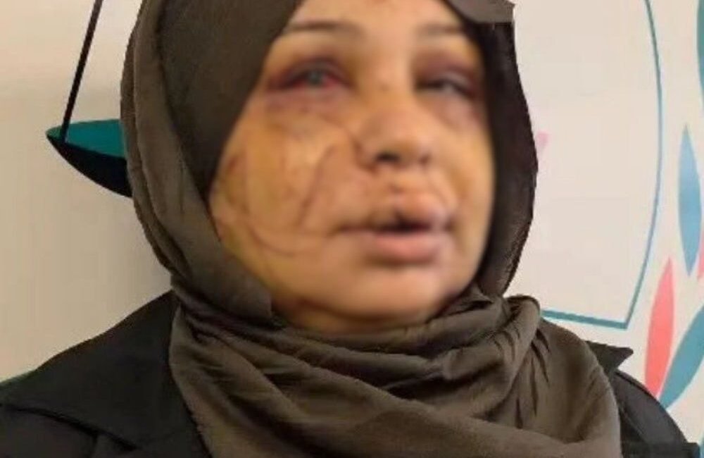 Eda KOÇ/ANKARA, (DH)- ANKARA'da eşi Fatma Çakmak’ı yüzünü keserek yaralayan