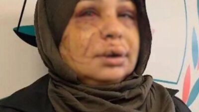Eda KOÇ/ANKARA, (DH)- ANKARA'da eşi Fatma Çakmak’ı yüzünü keserek yaralayan
