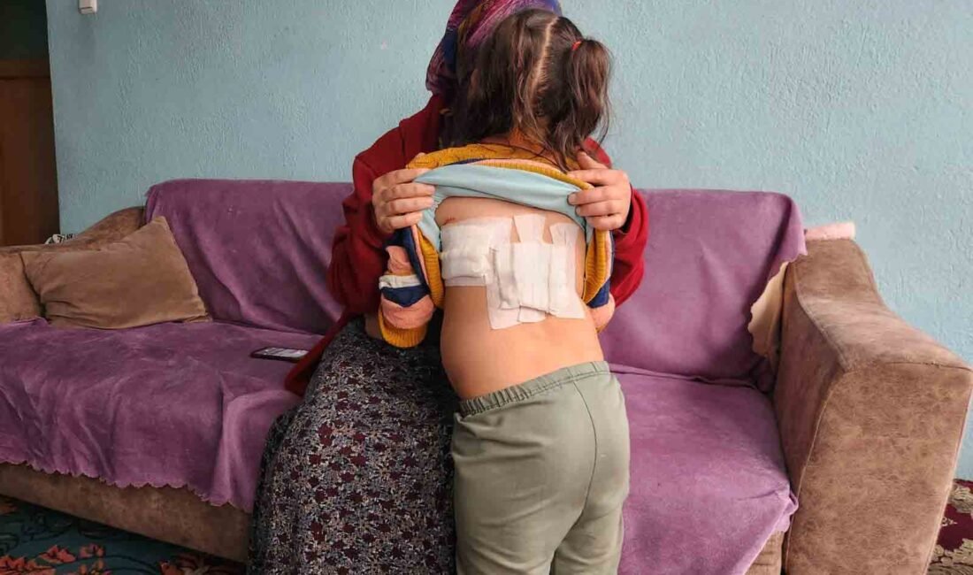 EŞEK BARINAĞA GÖTÜRÜLDÜ Afyonkarahisar'ın Çay ilçesinde evinin önünde oynarken F.D.A.'ya