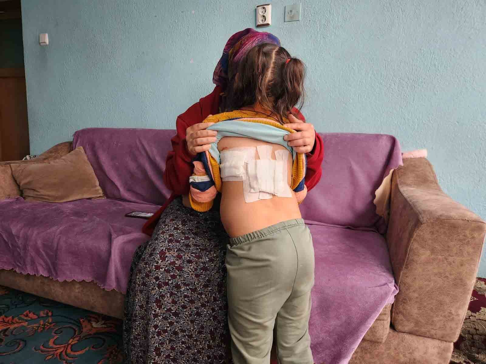 EŞEK BARINAĞA GÖTÜRÜLDÜ Afyonkarahisar'ın Çay ilçesinde evinin önünde oynarken F.D.A.'ya