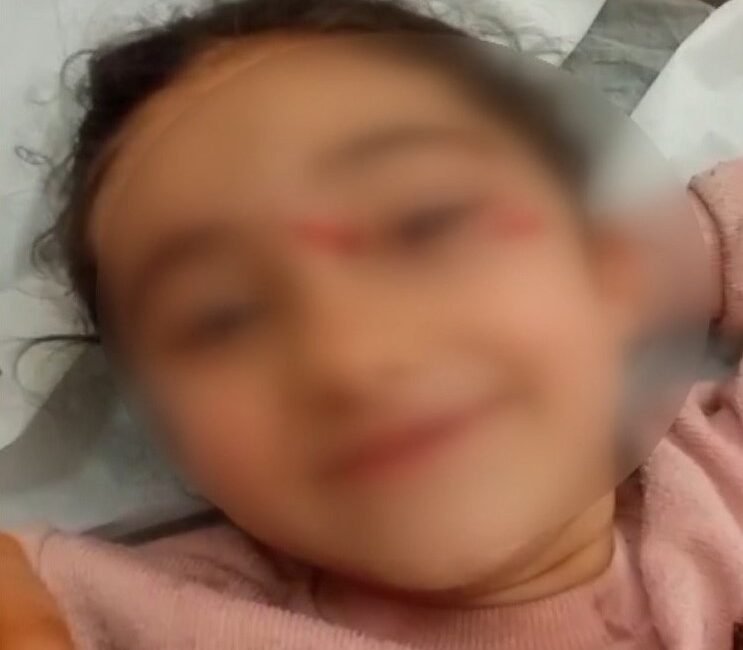 İstanbul – Eyupsultan’da okuldan eve dönen 6 yaşındaki çocuğa sokak köpekleri saldırdı Fırat ALKIZ-Ataberk KURT /İSTANBUL,(DHA)- EYÜPSULTAN'da okuldan servisle eve dönen Suriyeli