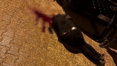 Sekvan KÜDEN/CİZRE (Şırnak), (DHA)- ŞIRNAK'ın Cizre ilçesinde sokakta yürürken uğradığı