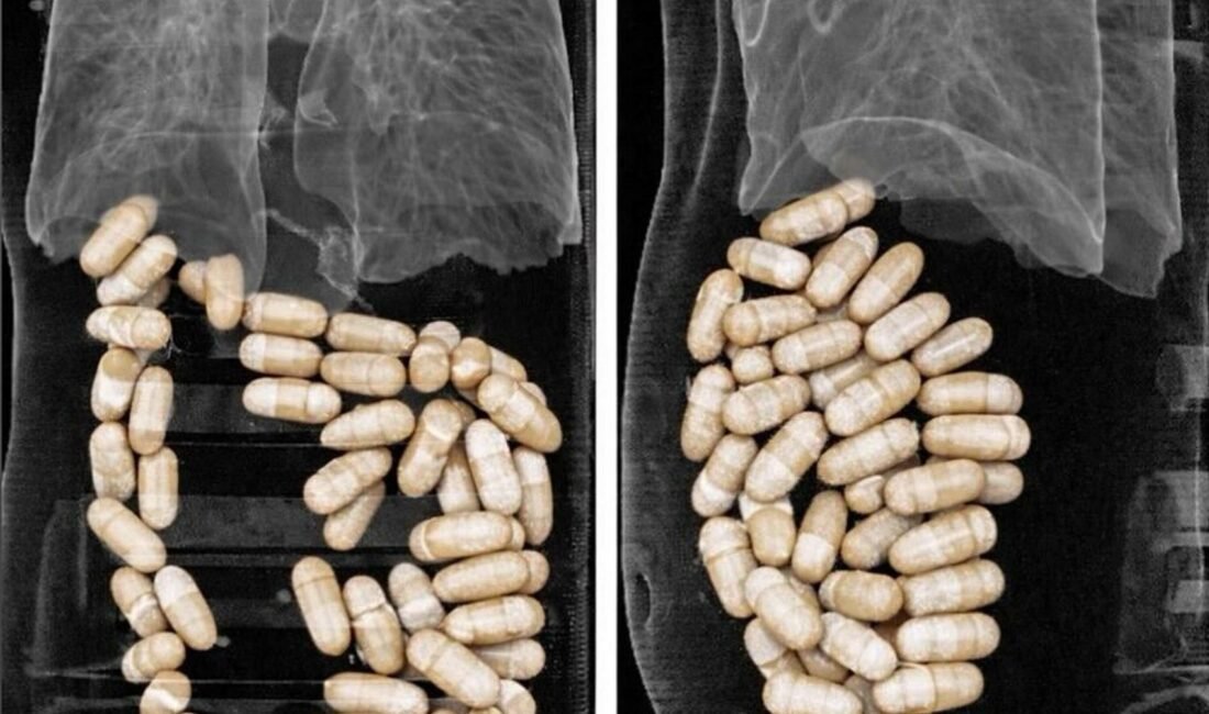 Kadir ÖZEN/İZMİR, (DHA)- İZMİR'de, havalimanında gözaltına alınan 2 şüphelinin midesinden